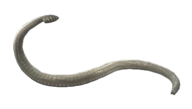 Menselijke parasieten