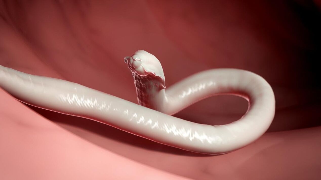 wormparasiet van de mens